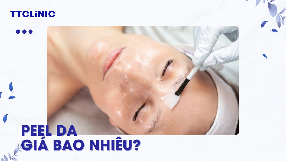 Peel da giá bao nhiêu? Cập nhật chi phí mới nhất 2025