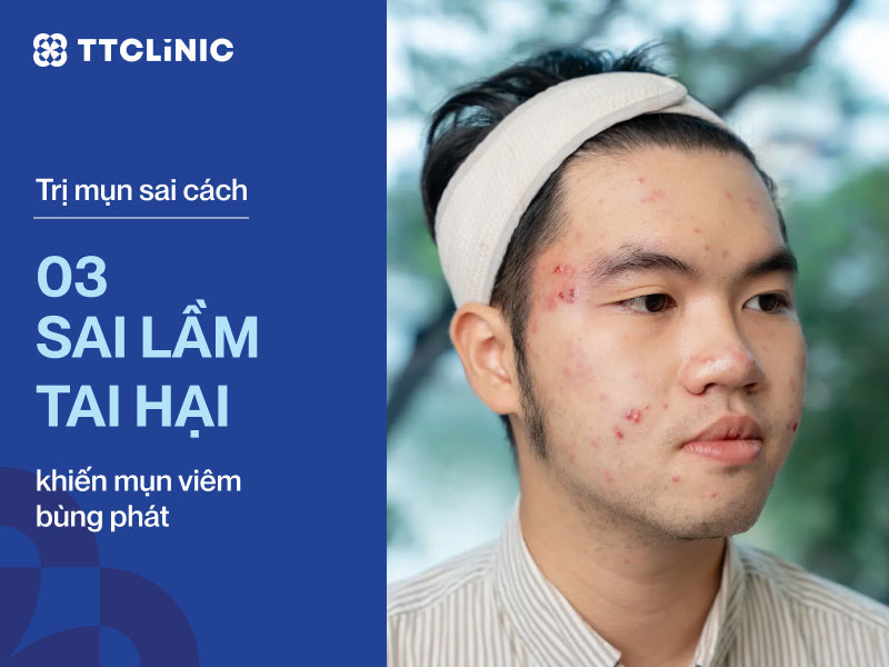 Trị mụn sai cách: 3 sai lầm tai hại khiến mụn viêm bùng phát