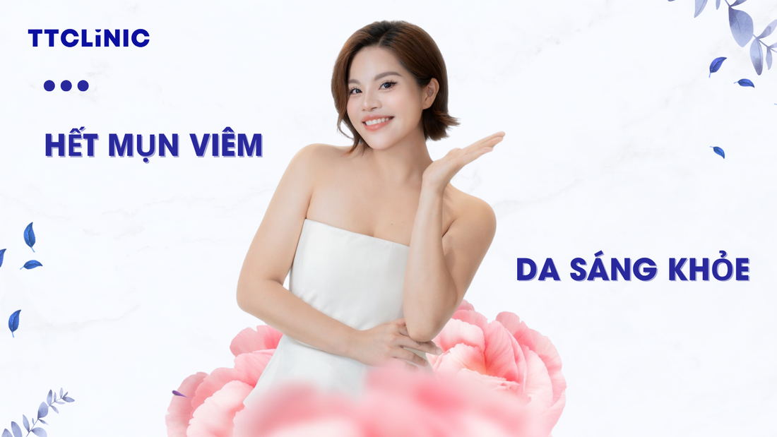 Cách trị mụn viêm an toàn, chuẩn y khoa