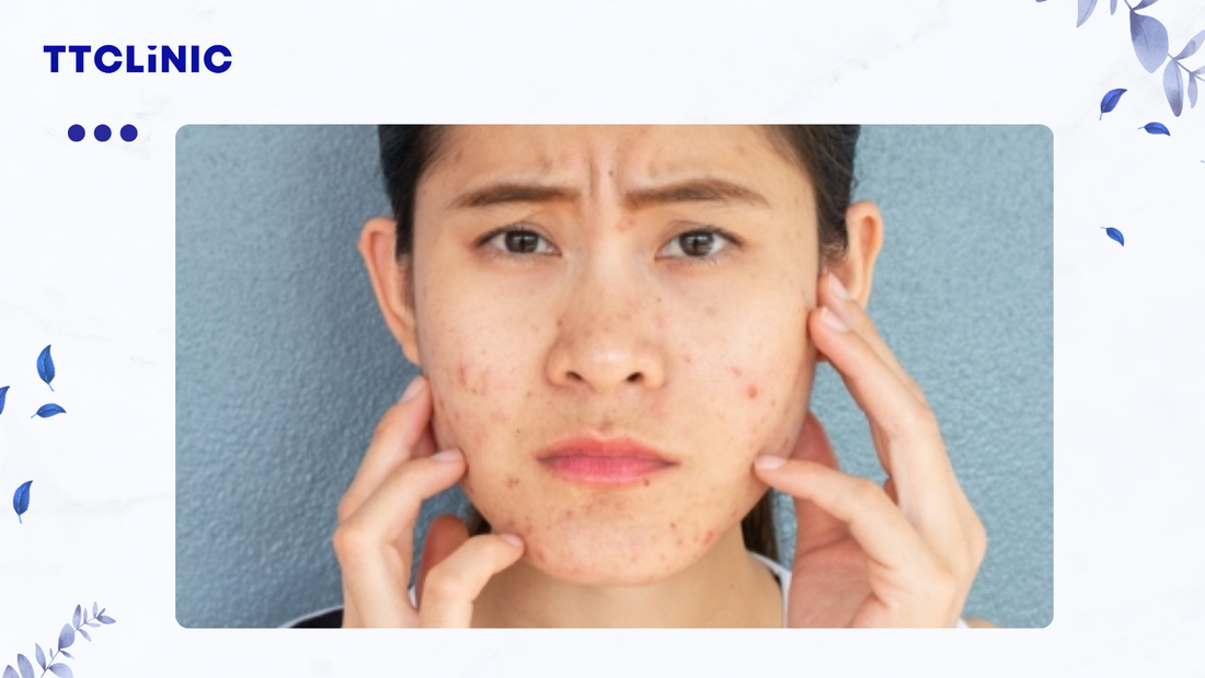 10 mẹo điều trị hiệu quả, có thể áp dụng ngay